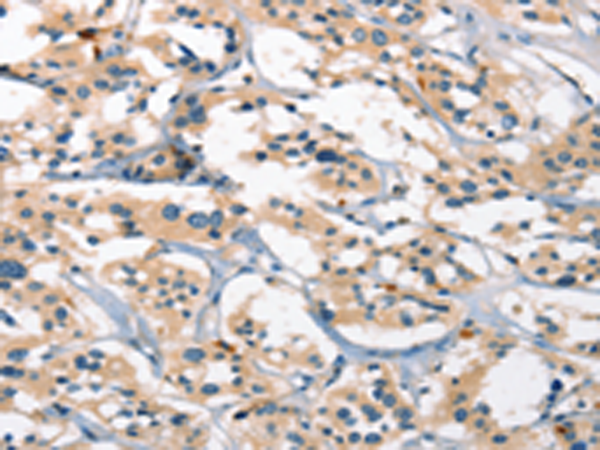Anti-GPR182 Rabbit Polyclonal Antibody