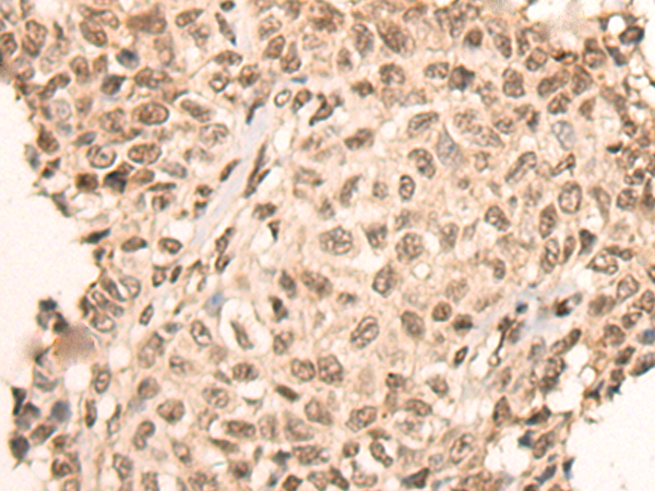 Anti-ATR Rabbit Polyclonal Antibody