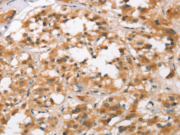 Anti-BCAS4 Rabbit Polyclonal Antibody