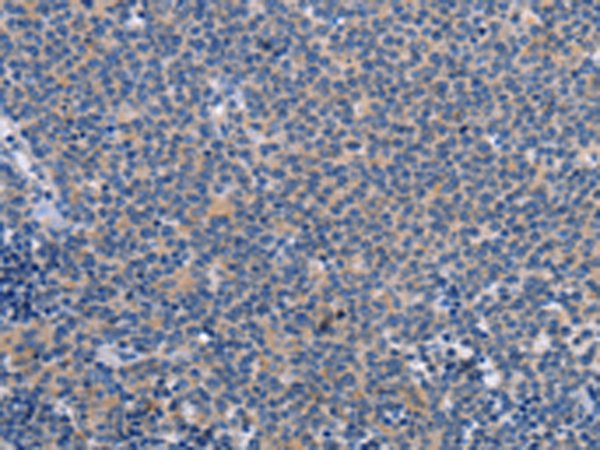 Anti-Cathepsin C Rabbit Polyclonal Antibody