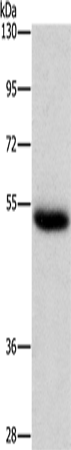 Anti-Cathepsin C Rabbit Polyclonal Antibody