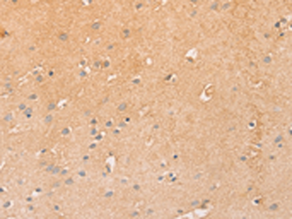 Anti-LEC Rabbit Polyclonal Antibody