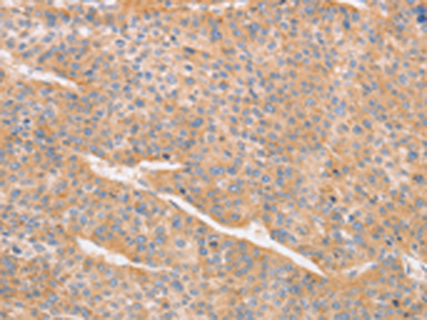 Anti-CD2AP Rabbit Polyclonal Antibody