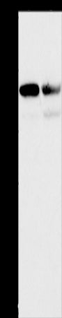 Anti-CD2AP Rabbit Polyclonal Antibody