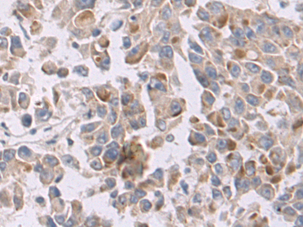 Anti-NCR1 Rabbit Polyclonal Antibody