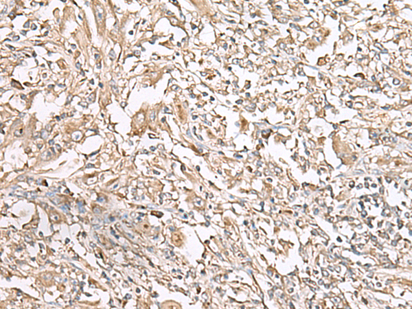 Anti-SIGLEC6 Rabbit Polyclonal Antibody