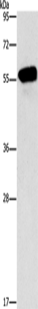 Anti-CDK19 Rabbit Polyclonal Antibody