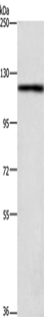 Anti-TSPY Like Protein 2 Rabbit Polyclonal Antibody
