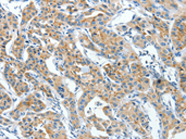 Anti-CKAP4 Rabbit Polyclonal Antibody