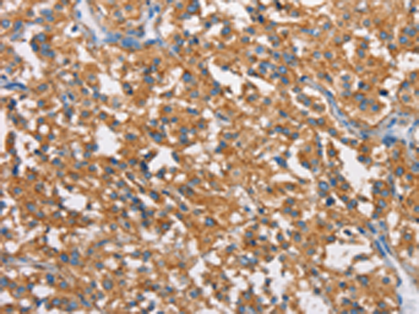Anti-Clathrin Heavy Chain Rabbit Polyclonal Antibody