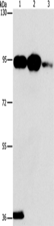 Anti-PLA2G4B Rabbit Polyclonal Antibody