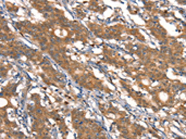 Anti-Cystatin B Rabbit Polyclonal Antibody