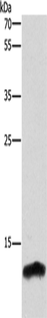 Anti-Cystatin B Rabbit Polyclonal Antibody