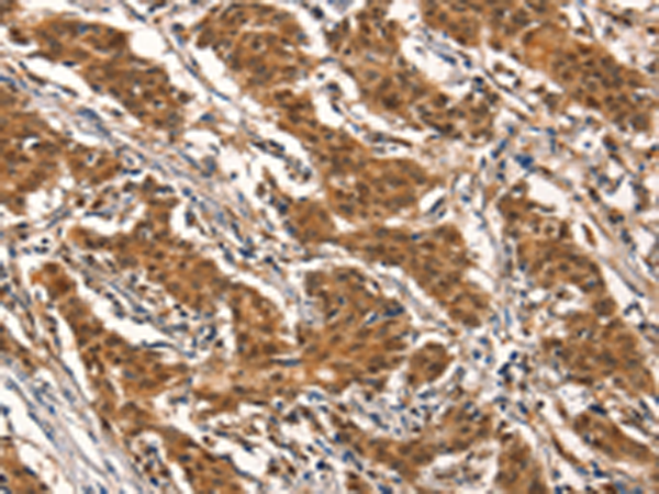 Anti-Cytochrome P450 2B6 Rabbit Polyclonal Antibody