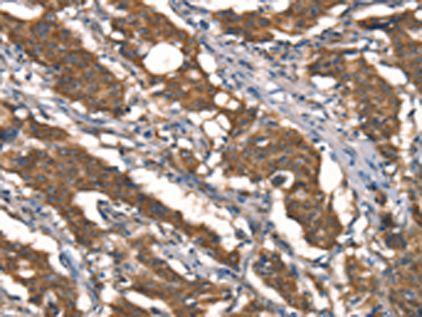 Anti-DAAM1 Rabbit Polyclonal Antibody