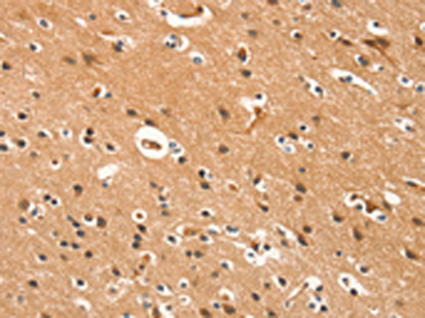 Anti-DDAH2 Rabbit Polyclonal Antibody