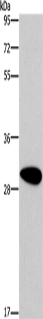 Anti-DDAH2 Rabbit Polyclonal Antibody