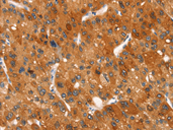 Anti-Dectin-2 Rabbit Polyclonal Antibody