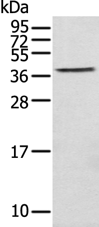 Anti-DNASE2 Rabbit Polyclonal Antibody