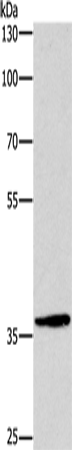 Anti-DUSP2 Rabbit Polyclonal Antibody