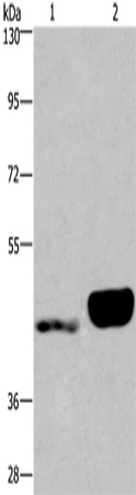 Anti-ENPP4 Rabbit Polyclonal Antibody