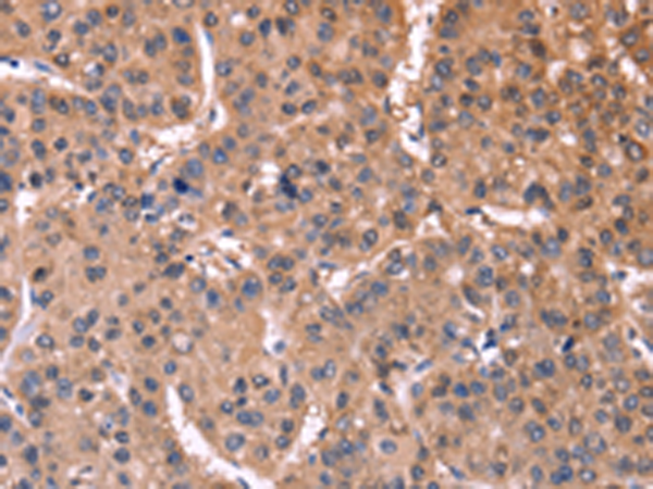 Anti-ETFB Rabbit Polyclonal Antibody