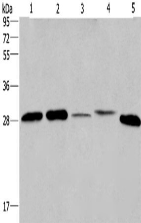 Anti-ETFB Rabbit Polyclonal Antibody
