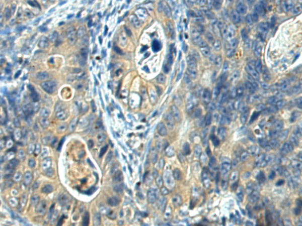 Anti-FUT1 Rabbit Polyclonal Antibody