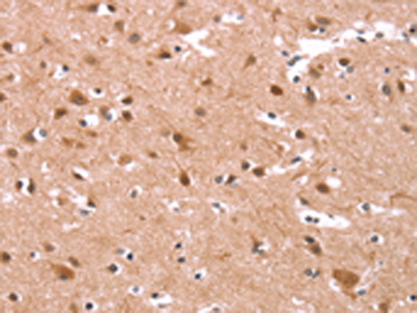 Anti-KCNJ6 Rabbit Polyclonal Antibody