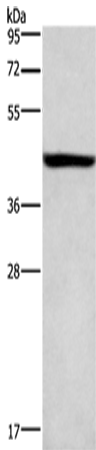 Anti-KCNJ6 Rabbit Polyclonal Antibody