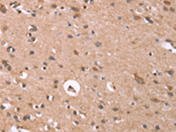 Anti-Glypican 6 Rabbit Polyclonal Antibody