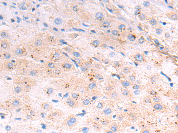 Anti-ADGRA2 Rabbit Polyclonal Antibody