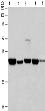 Anti-hnRNP F Rabbit Polyclonal Antibody