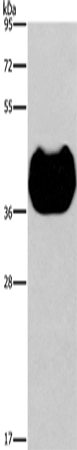 Anti-HRH2 Rabbit Polyclonal Antibody