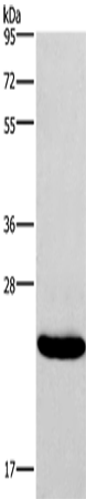 Anti-Interferon alpha 16 Rabbit Polyclonal Antibody