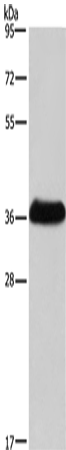 Anti-Interferon gamma Receptor 2 Rabbit Polyclonal Antibody
