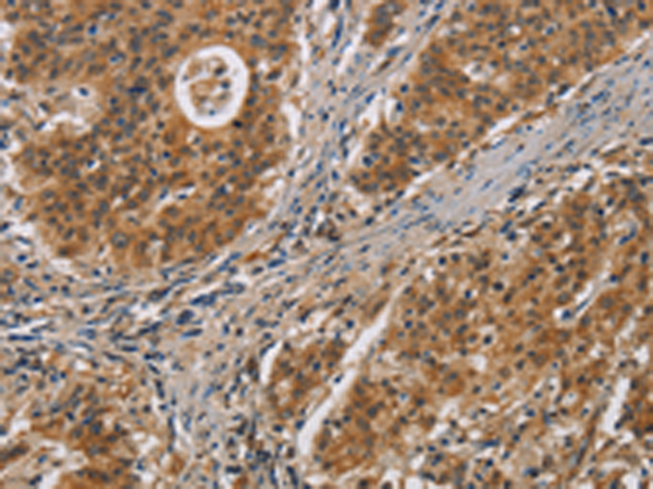 Anti-IL-17D Rabbit Polyclonal Antibody