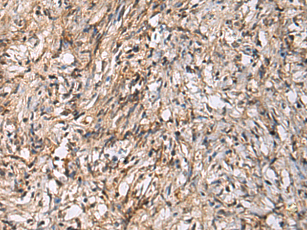 Anti-IL-19 Rabbit Polyclonal Antibody