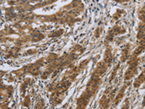 Anti-IL-5 Receptor alpha Rabbit Polyclonal Antibody