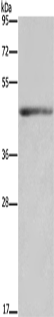Anti-IL-5 Receptor alpha Rabbit Polyclonal Antibody