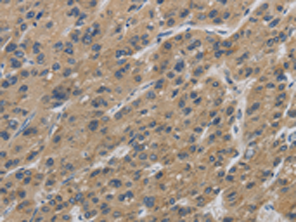 Anti-IPO7 Rabbit Polyclonal Antibody