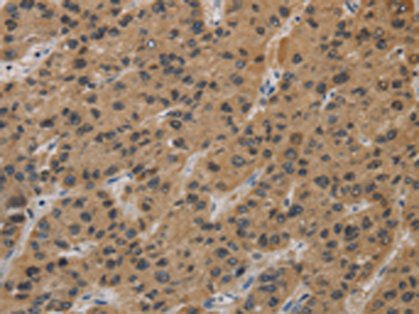 Anti-INPPL1 Rabbit Polyclonal Antibody