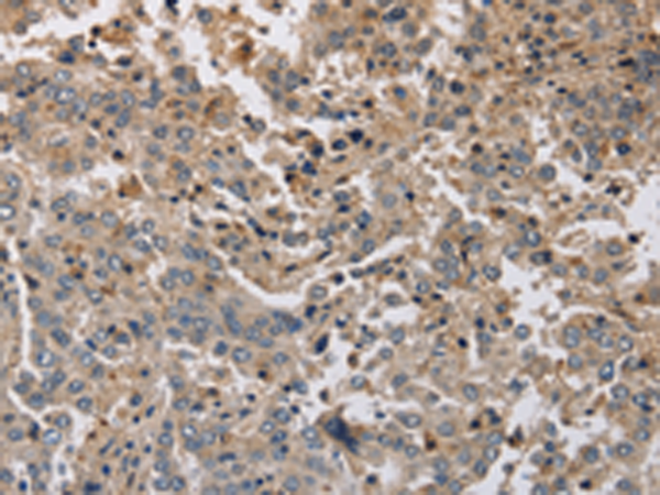 Anti-KCND1 Rabbit Polyclonal Antibody