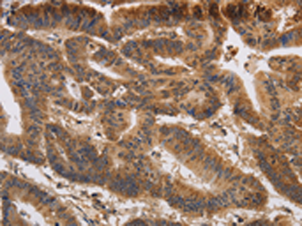 Anti-KCNK9 Rabbit Polyclonal Antibody