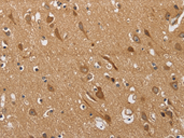 Anti-KCNQ4 Rabbit Polyclonal Antibody