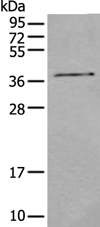 Anti-CNMD Rabbit Polyclonal Antibody