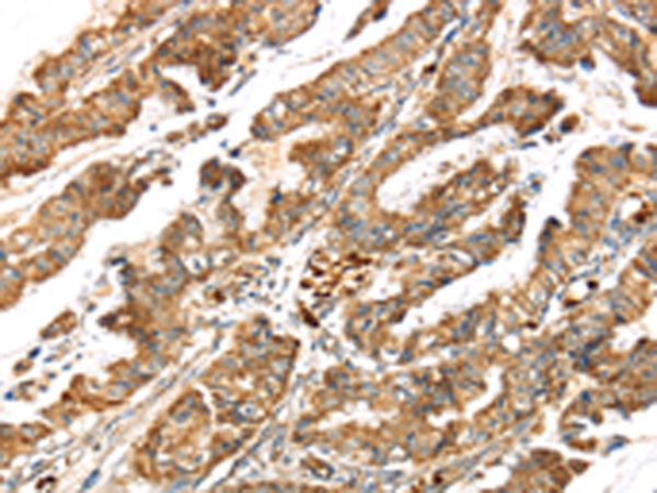 Anti-LONP1 Rabbit Polyclonal Antibody