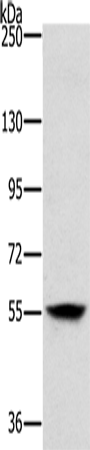 Anti-LOXL1 Rabbit Polyclonal Antibody