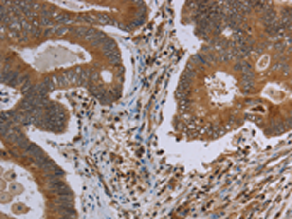 Anti-MAVS Rabbit Polyclonal Antibody