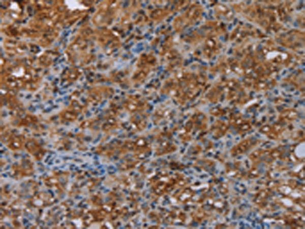 Anti-ME1 Rabbit Polyclonal Antibody